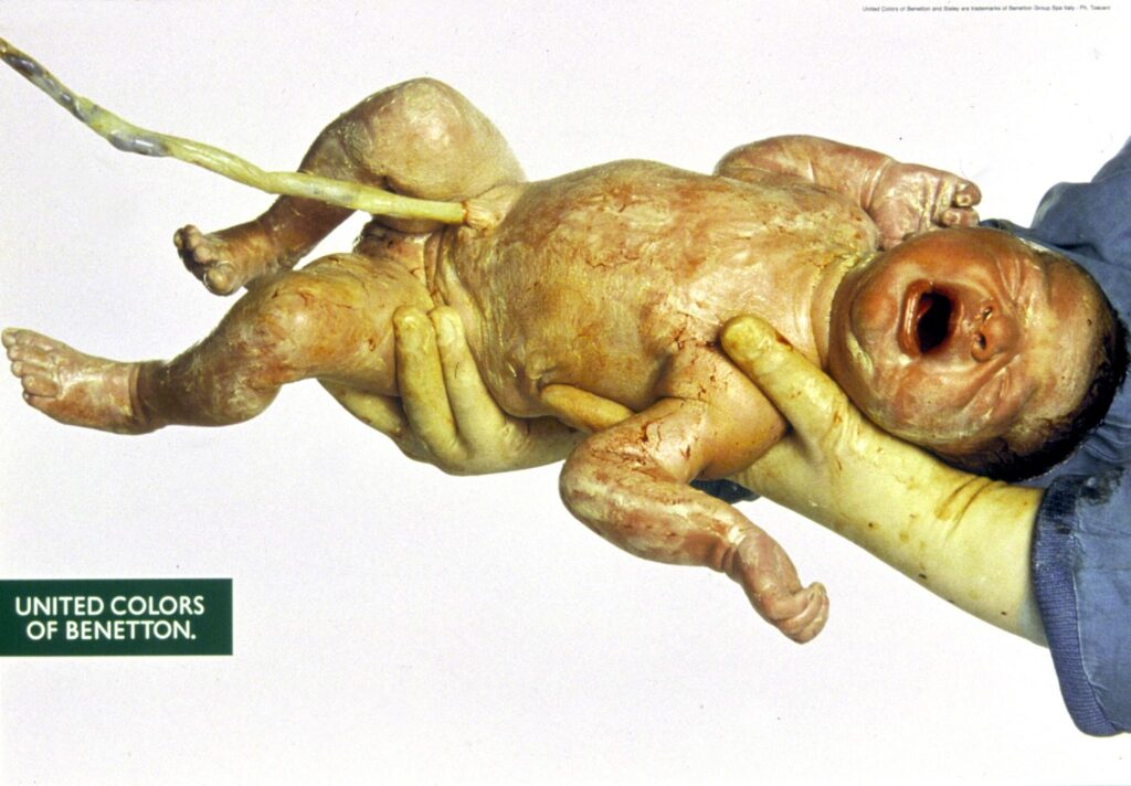 Neonata - Le campagne più famose di Oliviero Toscani